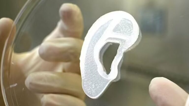 3D üsulu ilə çap olunmuş qulaq bir qadına köçürülüb