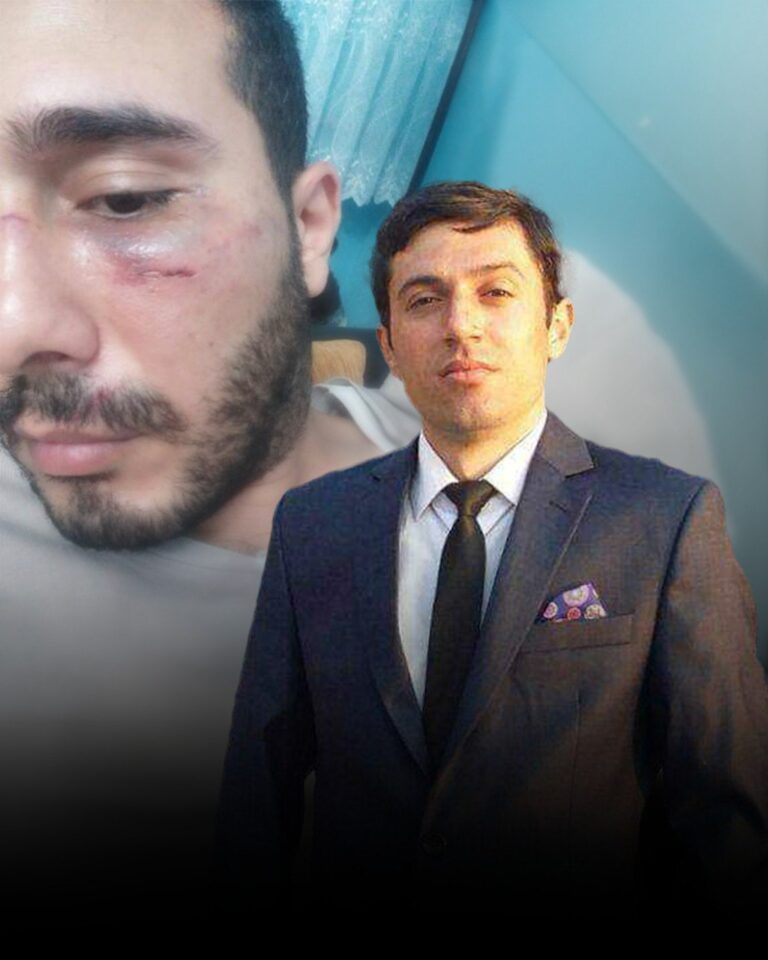 Naxçıvanda məmur şikayətçinin burnunu qırıb