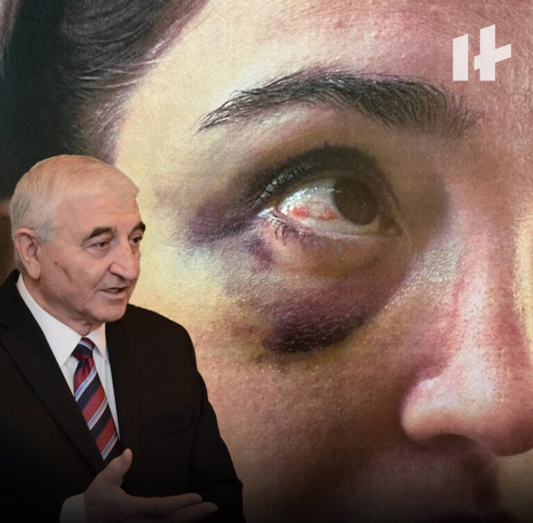 Məzahir Pənahovun oğlu arvadına işgəncə verib